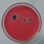 Ecoli