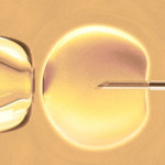 IVF