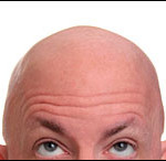 Sneller kaal en haaruitval bij mannen door luchtvervuiling