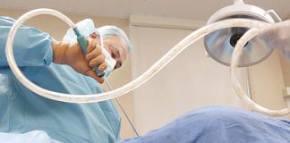 Hoe werkt liposuctie? liposuctie