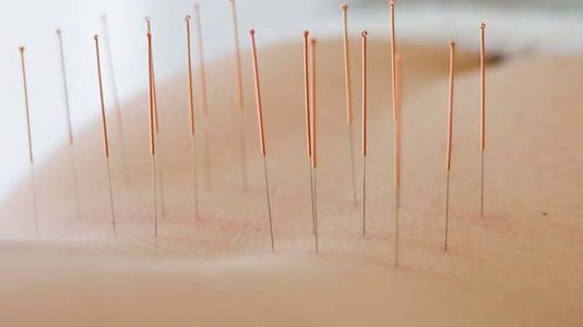 Hoe werkt acupunctuur? acupunctuur