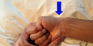 Wat is het syndroom van De Quervain? De Quervain