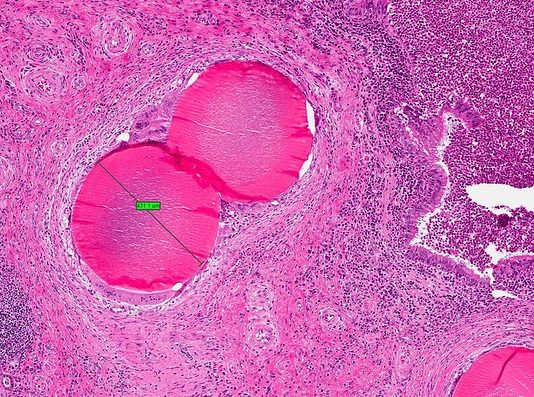 Wat is een vleesboom precies? vleesboom