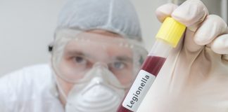 Verklein het risico op de veteranenziekte Onderzoeker in laboratorium houdt reageerbuis met legionella