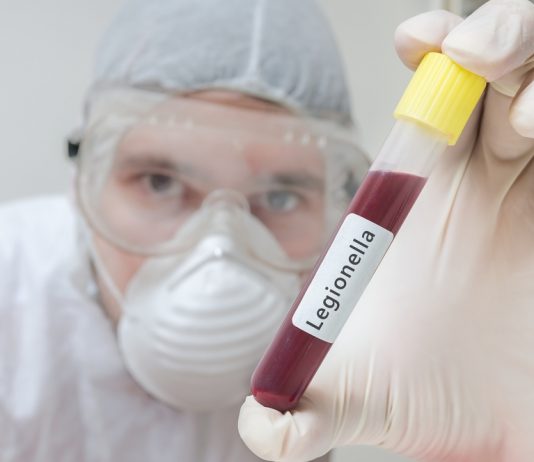 Verklein het risico op de veteranenziekte Onderzoeker in laboratorium houdt reageerbuis met legionella