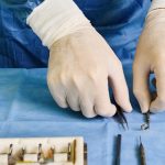 Wanneer is specialistische chirurgische zorg nodig en wat houdt het in Man met witte handschoenen legt gereedschap voor operatie klaar
