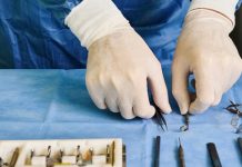 Wanneer is specialistische chirurgische zorg nodig en wat houdt het in Man met witte handschoenen legt gereedschap voor operatie klaar